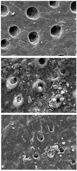 Biomin F toothpaste occlude tubules