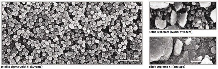 Compare Tokuyama Estelite particle sizes to other brands