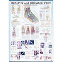Healthy and Diseased Feet Chart..