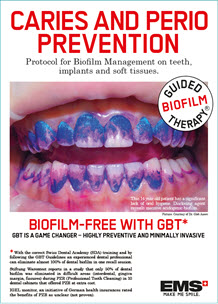 EMS Caries and Perio Prevention Brochure