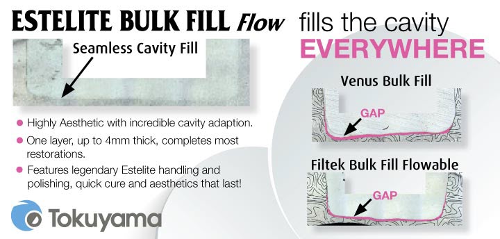 Estelite Bulk Fill Cavity Comparison